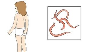 Symptômes de parasites dans le corps humain