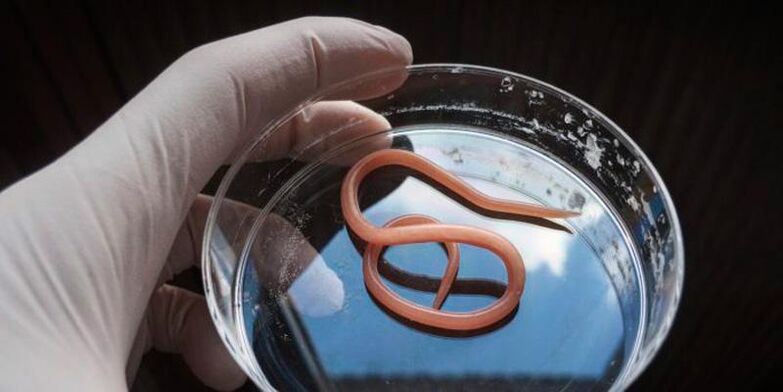 Ascaris est un helminthe intestinal rond qui vit dans le système digestif