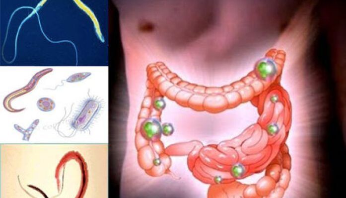parasites dans l'intestin humain